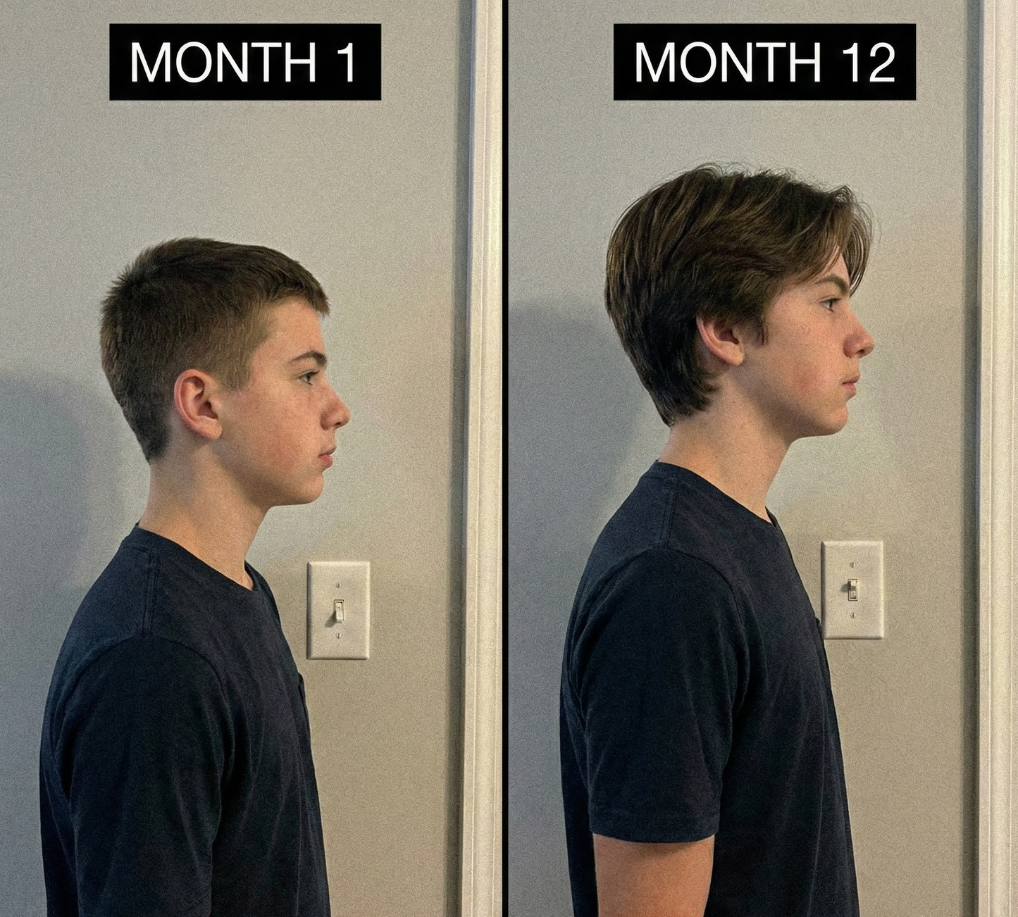 Noctara Health™ Viral Heightener Gummies (Limited Time Deal Only)